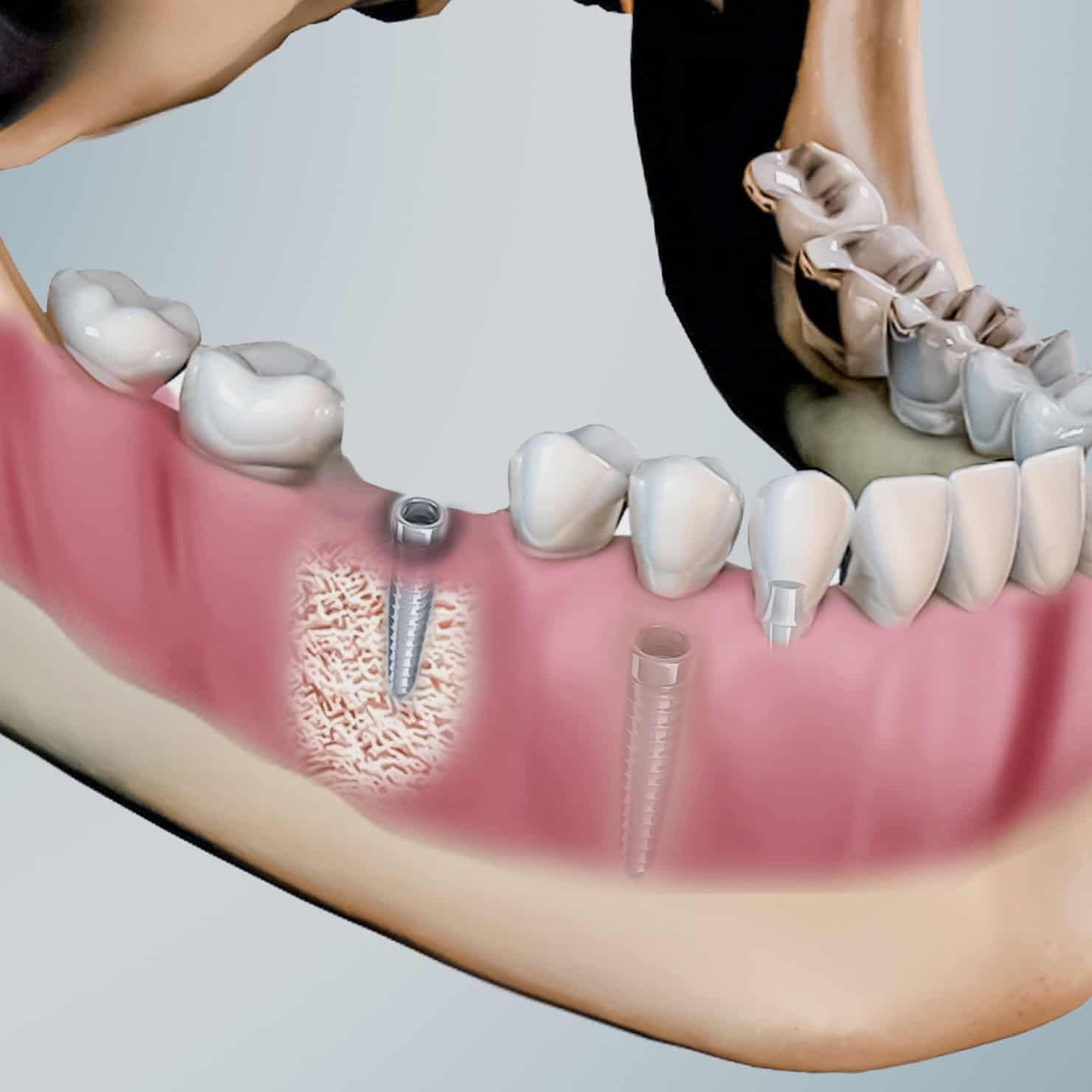 procedure